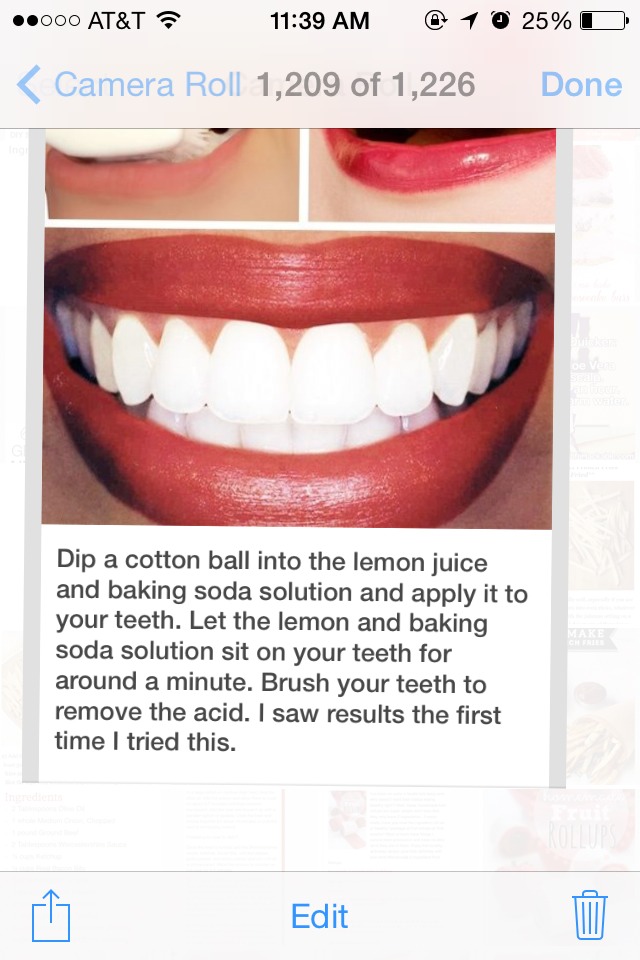 ✨✨💥How To Get Sparkling White Teeth!!✨✨💥😁