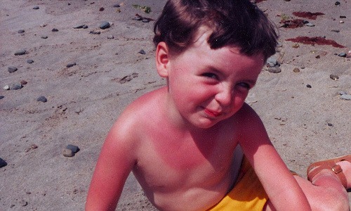 9. Sunburn – Sometimes sun block doesn’t always protect your little ones from sunburn. If you have burnt little kiddos you don’t have any aloe, rub some cucumber on them. Many doctors even use cucumber to treat patients with irritated skin and sunburns.