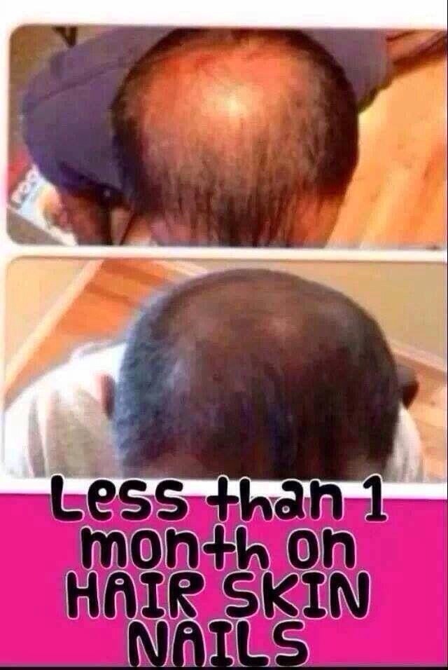 Incredible Hair Skin Nails 