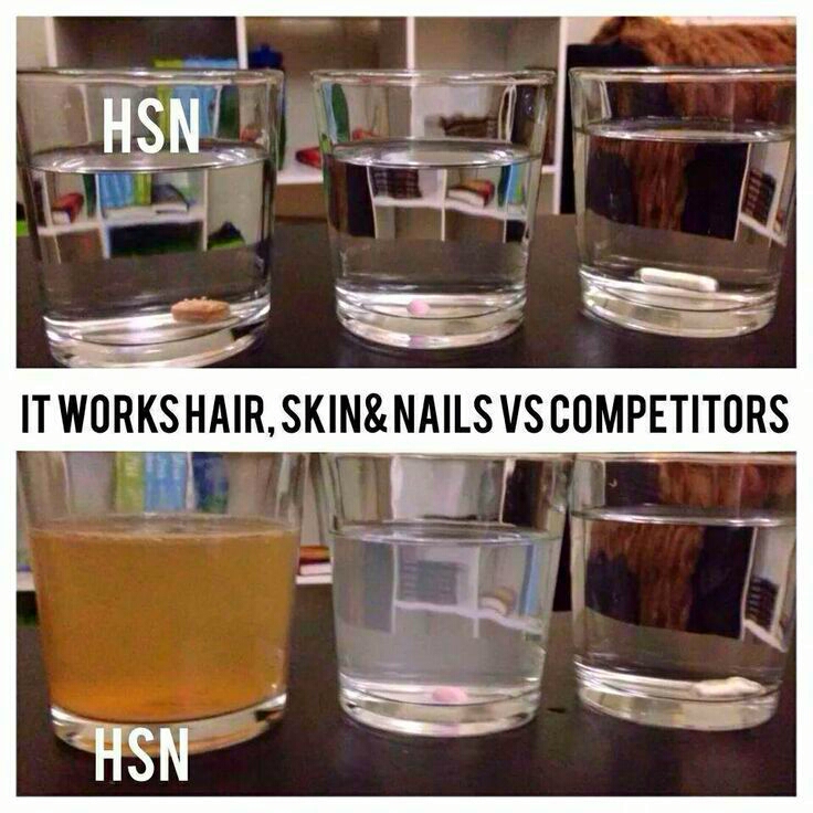 total major difference!!! 