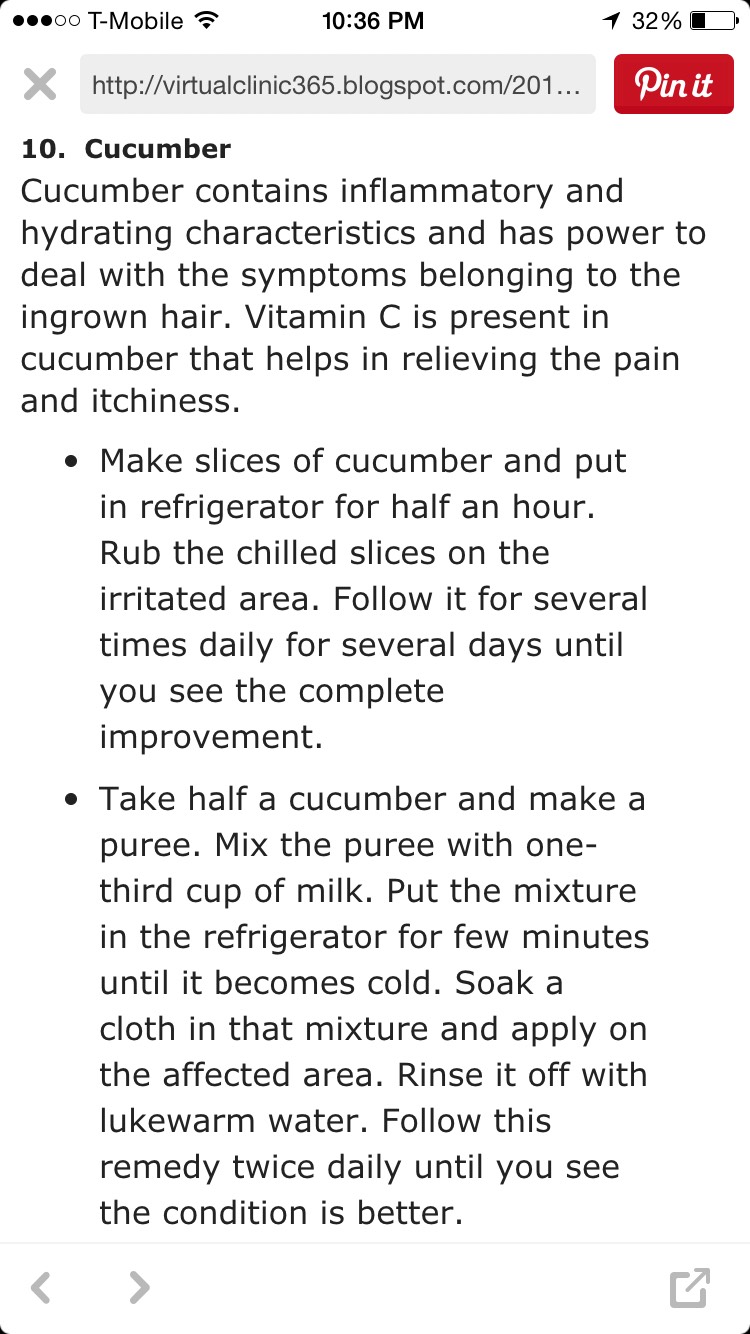 How To Get Rid Of Ingrown Hair! 