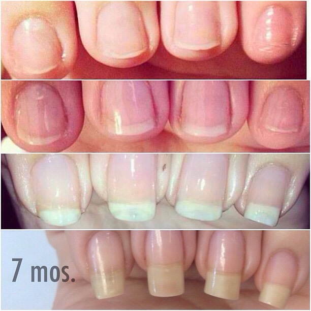 How To Grow Your Nails Really Long