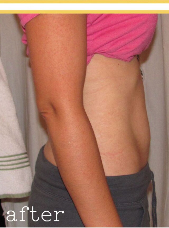 Lose 1 Inch Over Night DIY Body Wrap