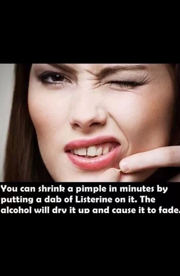Listerine on a cotton tip minimises and drys out pimples, even tricky hidden/under skin pimples

- KEEP IN MIND, listerine is very hardy, and can damage your skin so please use in moderation and ALWAYS swab test on sensitive skin and DON'T forget to moisturise! ☺️