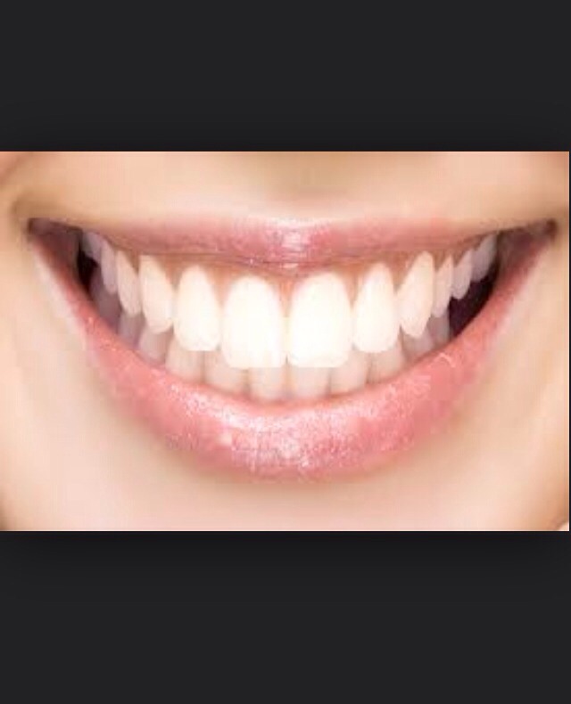 Practice your smile so you can have your best smile!