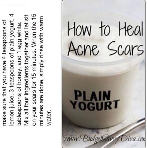 How To get Rid Of Acne Scars..the Natural Way