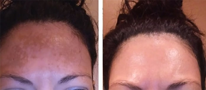 Customer photo
