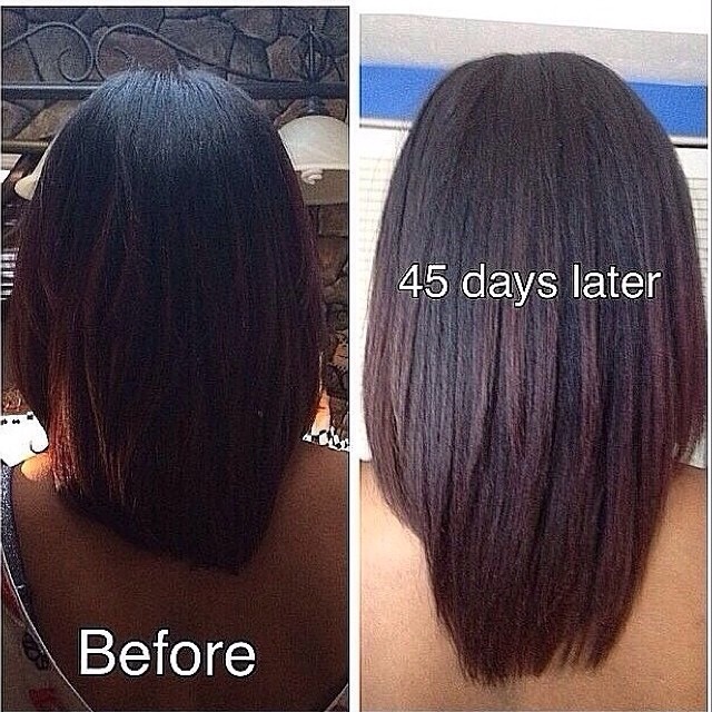 Easy Way To Grow Hair Back Fast