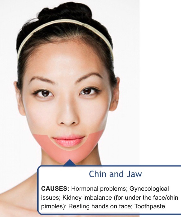 Face Mapping (Acne) - What Is Your Acne Telling You? 