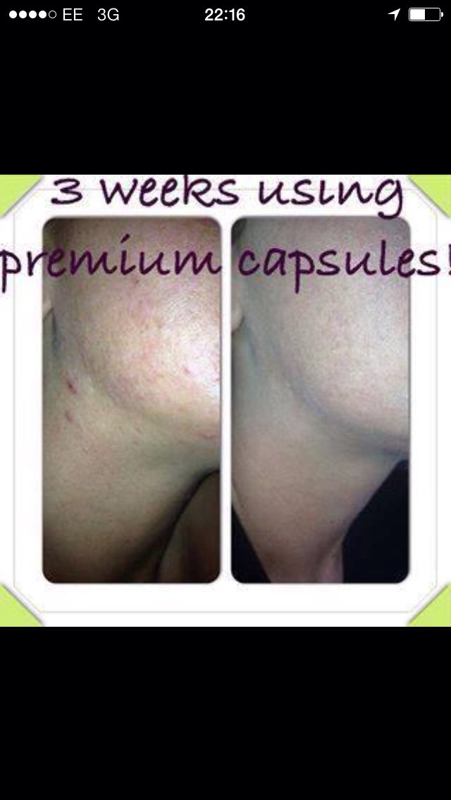 Juice Plus - Hair Growth Nail Growth And Clearer Skin  