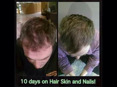 Want Healthy Hair? Text 931.510.2973