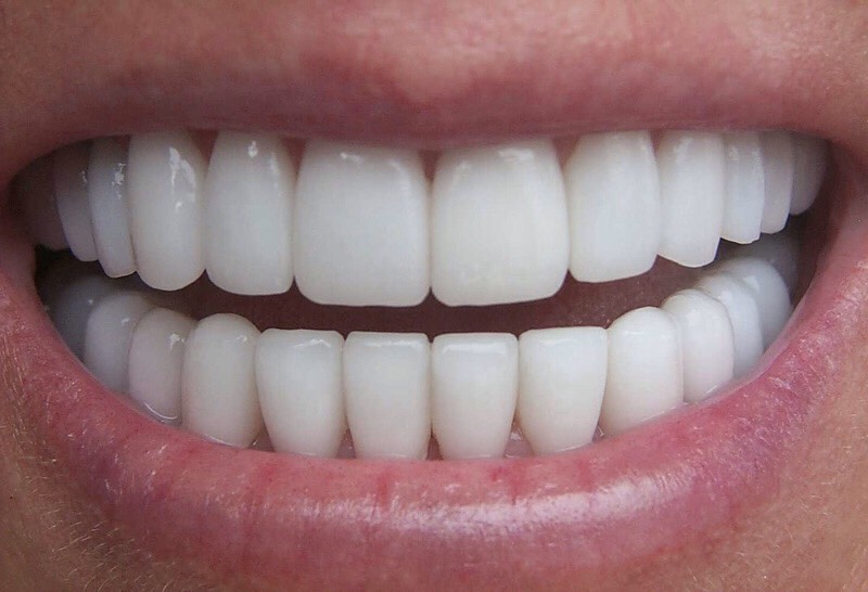 TOOTHACHE: Make a paste of one teaspoon of cinnamon powder and five teaspoons of honey and apply on the aching tooth. This may be applied three times a day until the tooth stops aching.