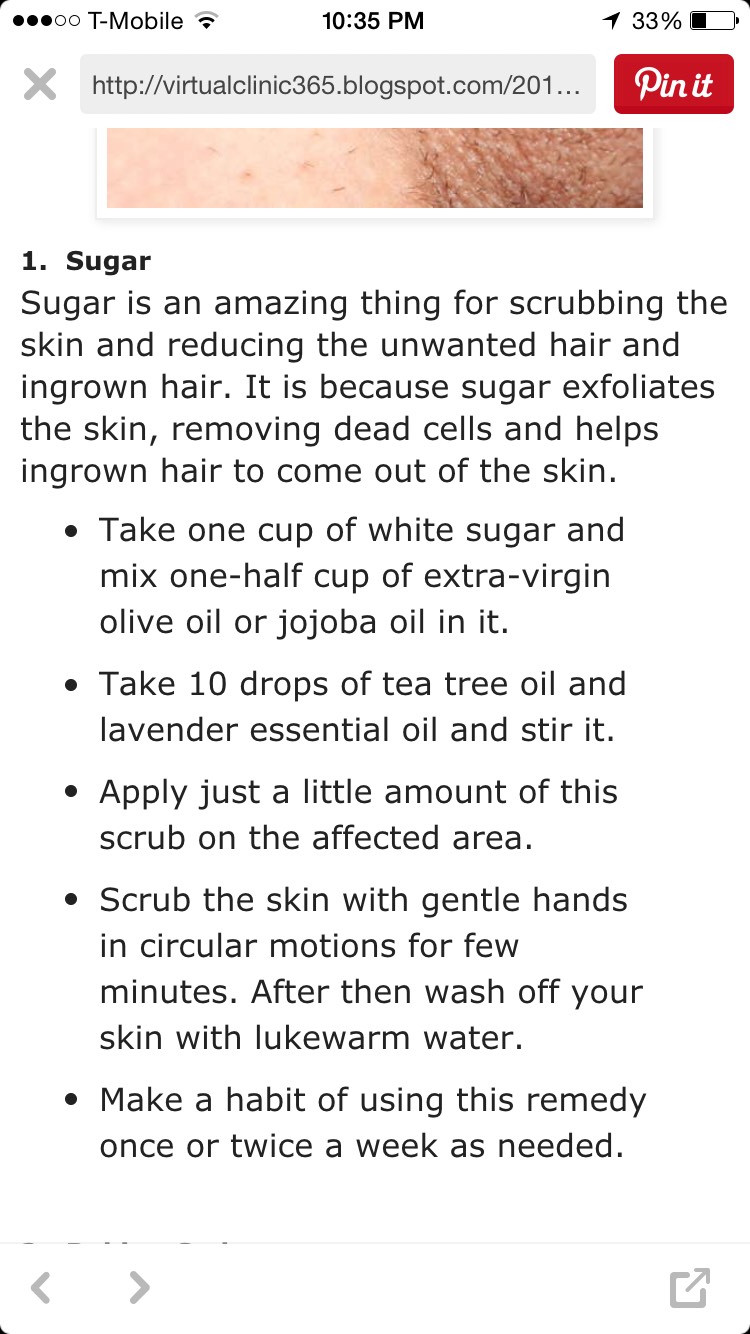 How To Get Rid Of Ingrown Hair! 