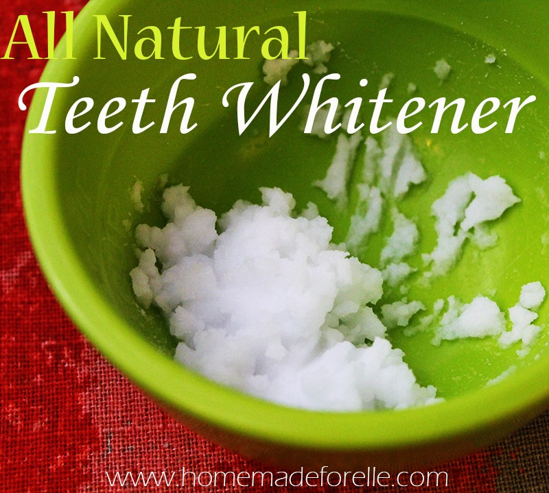 White Teeth 