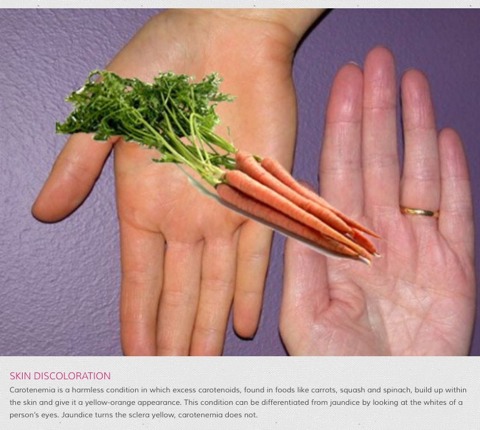 12 Weird Side Effects Of Healthy Foods.