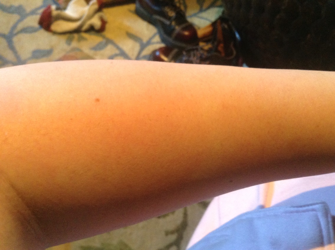And here is my arm after the waxing :)