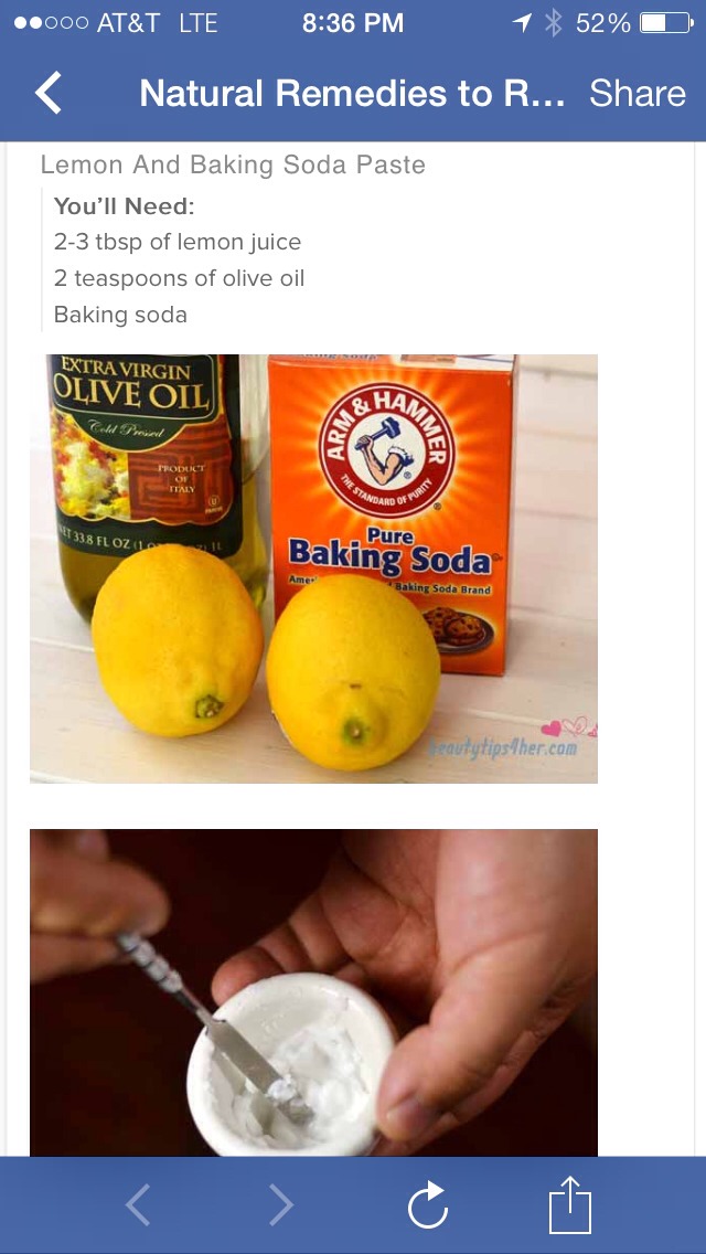 Natural Remedies to Remove Corn and Calluses – This Really Works
