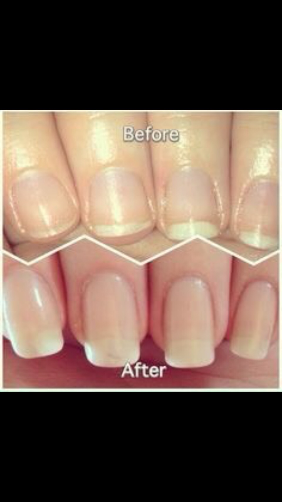 How To Grow Nails Fast