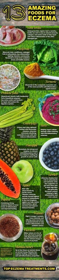 7 Natural Remedies For Eczema