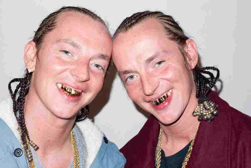 A study was just done with two twins. One at a sugarless diet, one an almost fat less diet. Results?  