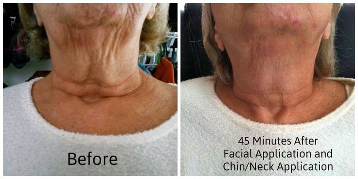 Facial wraps
