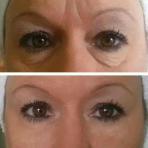 You could have flawless skin in just 2 minutes... 