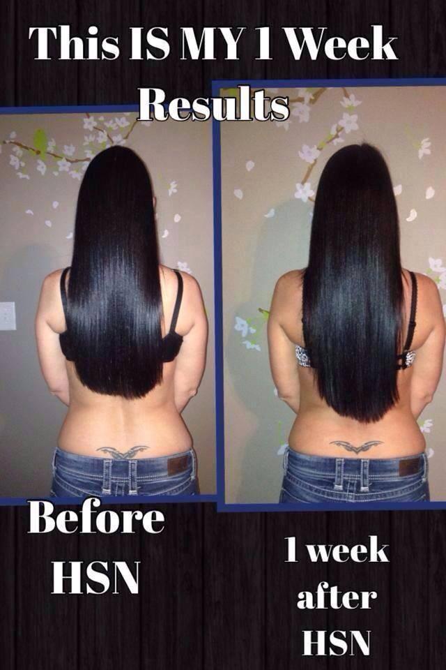 Hair Skin And Nail