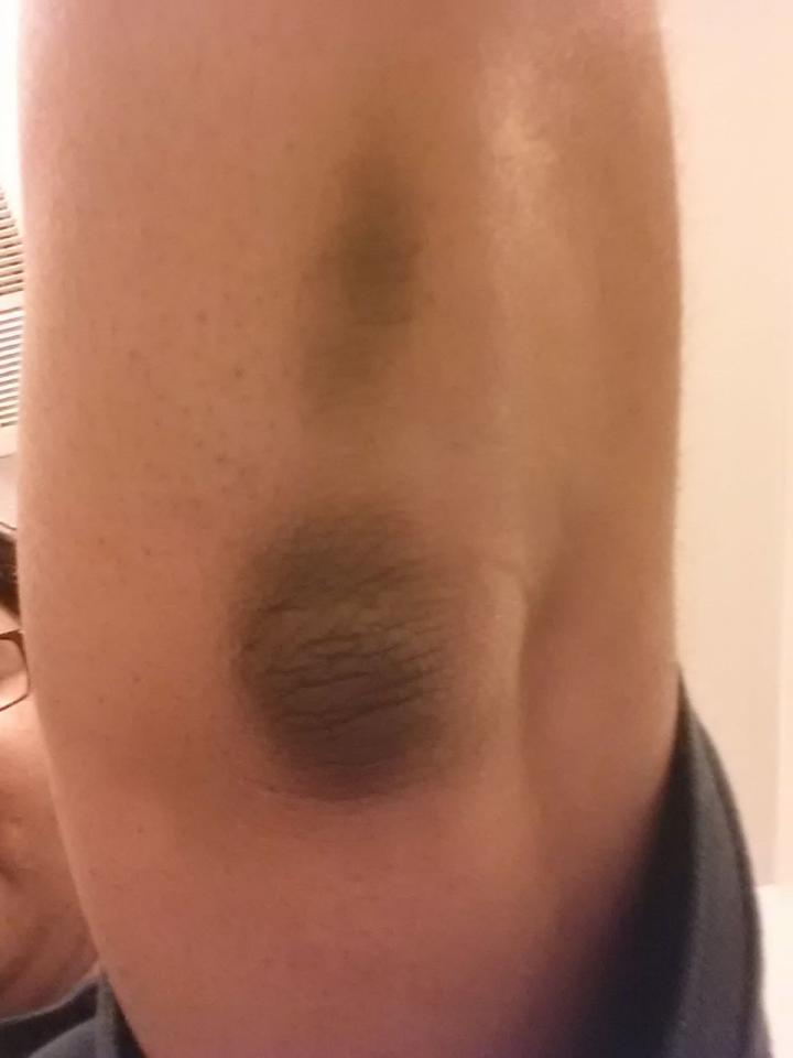Elbow and knee bleacher: "If your elbows and knees appear dark, simply rub them with half of a lemon