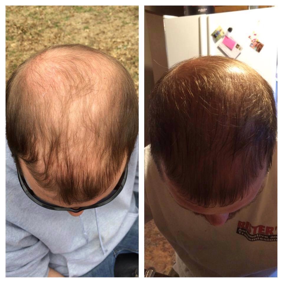 Longer Stronger Thicker Healthier Hair  Hair 1 Week 😀😀