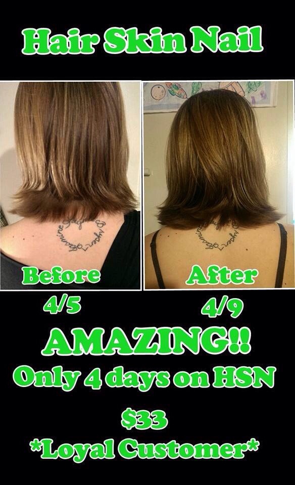 Easy Way To Grow Hair Back Fast
