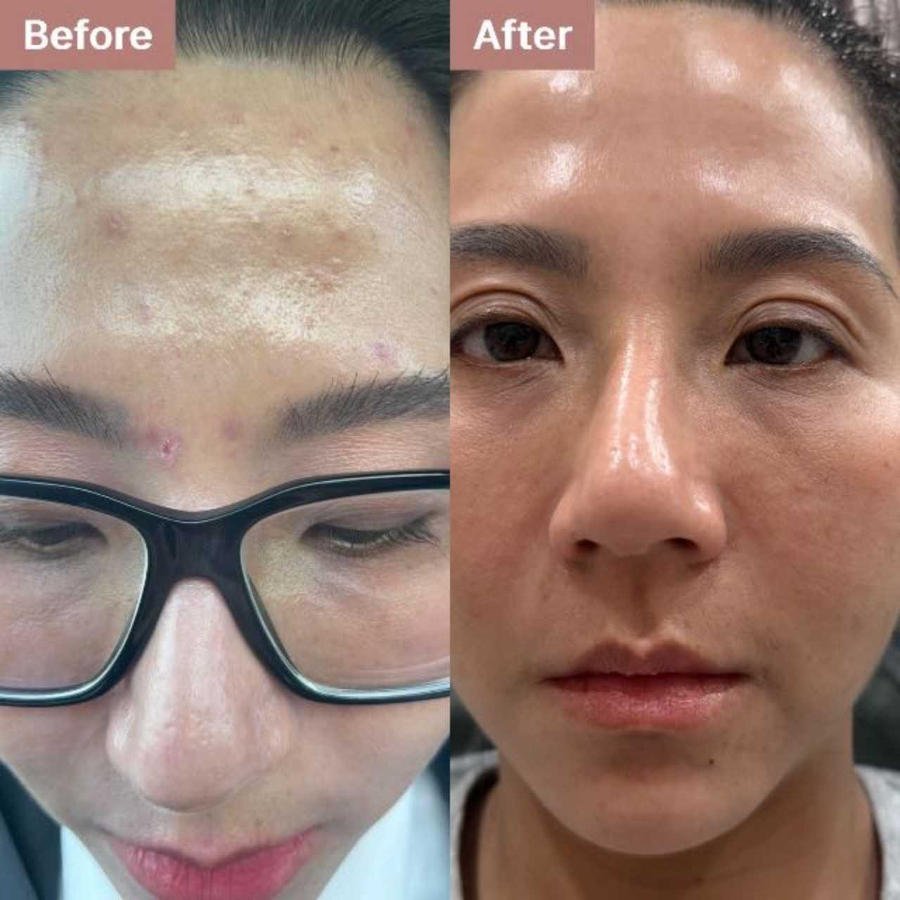 user-7-1239 -- before and after, 8 weeks