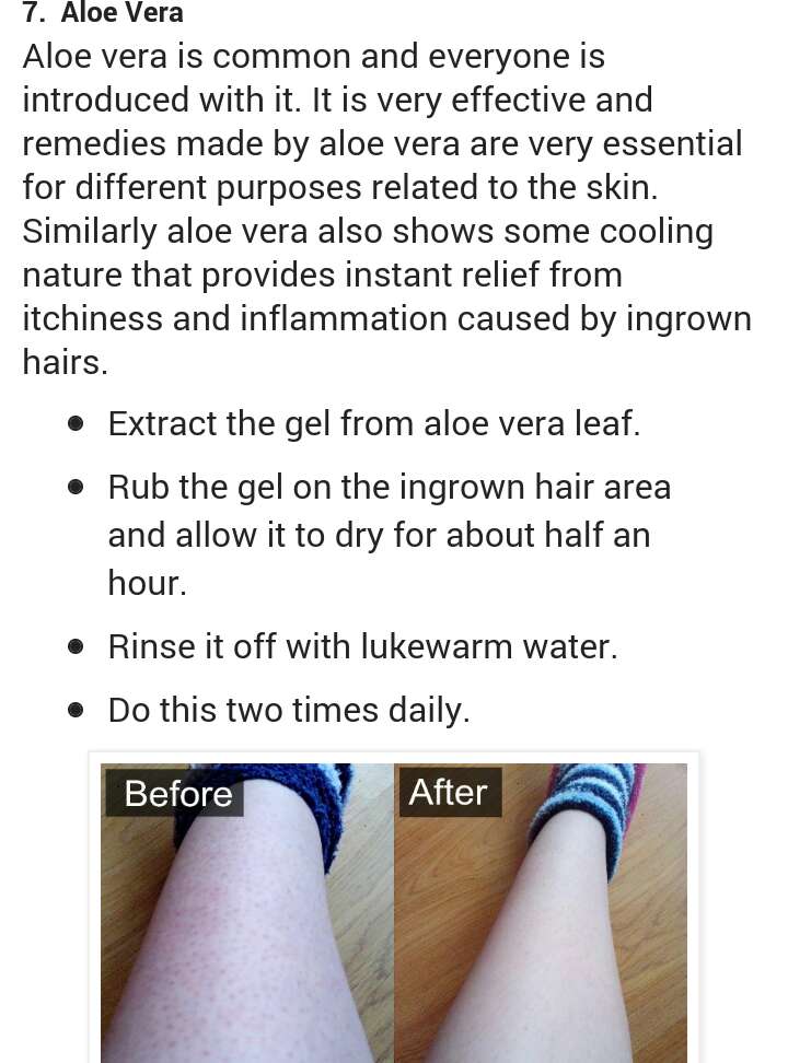 GETRID OF IN GROWN HAIRS LIKE RAZOR BUMPS OR SKIN PIMPLE 