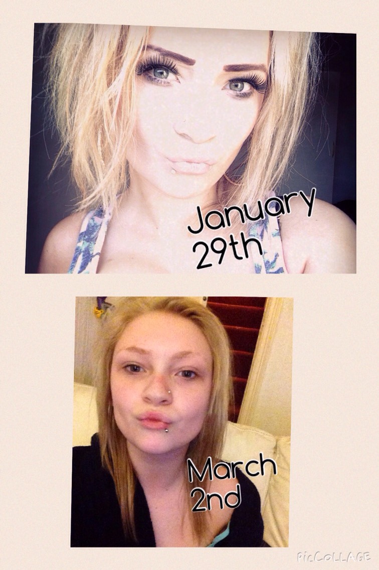 Ignore the no makeup☺️ the results are crazy though! So worth it! You do not need a lot of it either, you will feel the product work too! That's the great thing you know it works when you feel the tingle! 🙈