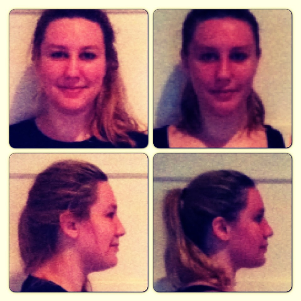 Loose Those Chubby Chicks-face Exercise Really Works!!!