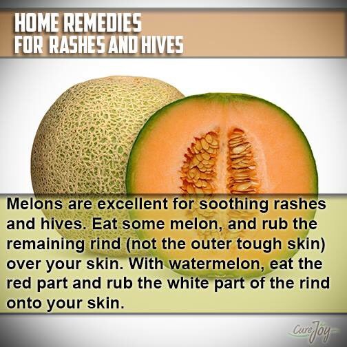Natural Remedies, Something Or Other From Your Kitchen For Your Cure - Part 4 (Ayurveda)