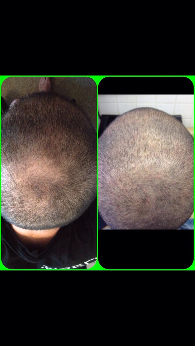 Easy Way To Grow Hair Fast