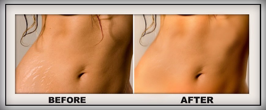 And my last tip is to take castor oil an apply it every night before bed ! Works like a charm