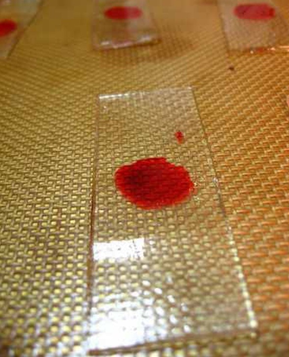 Dexter Edible Candy Blood Slides Halloween Recipe