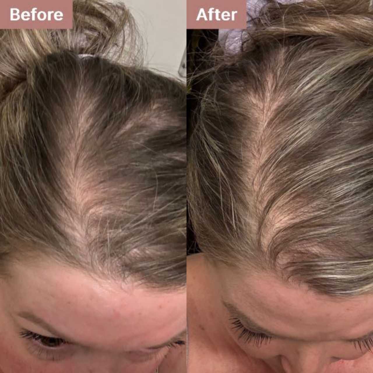 user-20-29545 -- before and after, 8 weeks