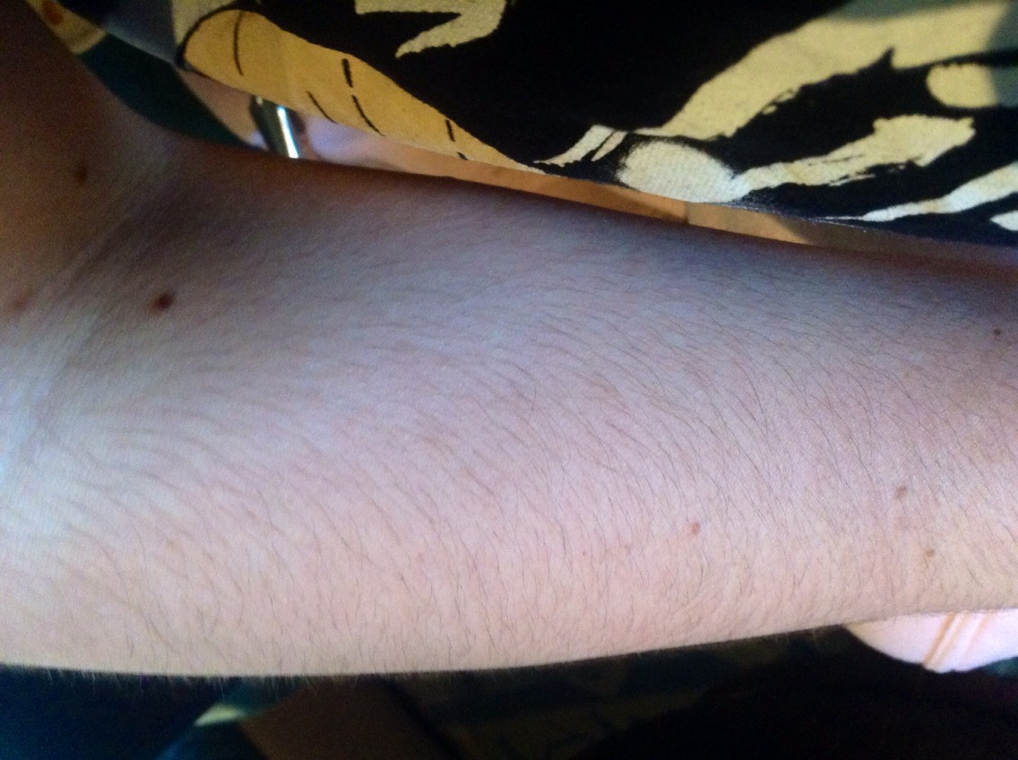 So here is my arm to start