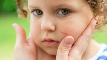 4. Bye Bye Boo Boos!From the moment your child takes their first steps, they're bound to have some tumbles (what kid hasn't skinned a knee?). To relieve the owies, ouchies and boo boos, apply Waxelene on minor scrapes and burns to soothe the skin and add moisture. Waxelene will provide a bandaid-like barrier to prevent any bacteria from entering the wound. Toss a tube of Waxelene in your bag every day to take care of those tumbles and fumbles on the go!