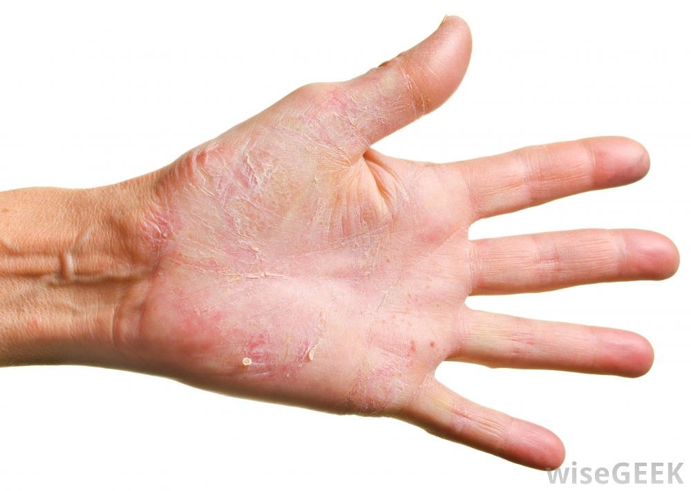 Repair cracked and chapped feet or hands by covering them with a thin layer of petroleum jelly, then wearing cotton socks or gloves while you sleep.