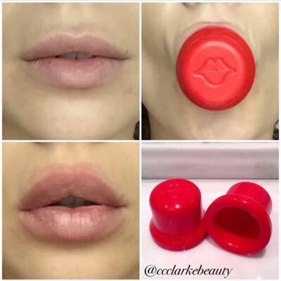 How To Get Extra Volume In Your Lips ☺️