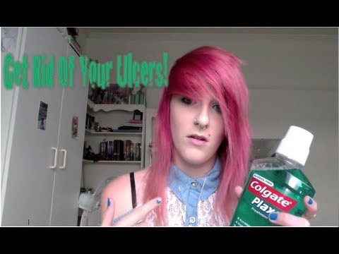 4 Easy Ways To Get Rid Of Lip Ulcers
