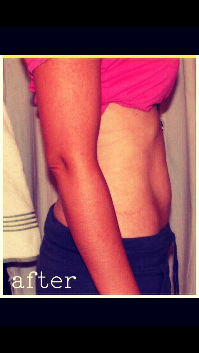 Loose Water Weight Overnight!