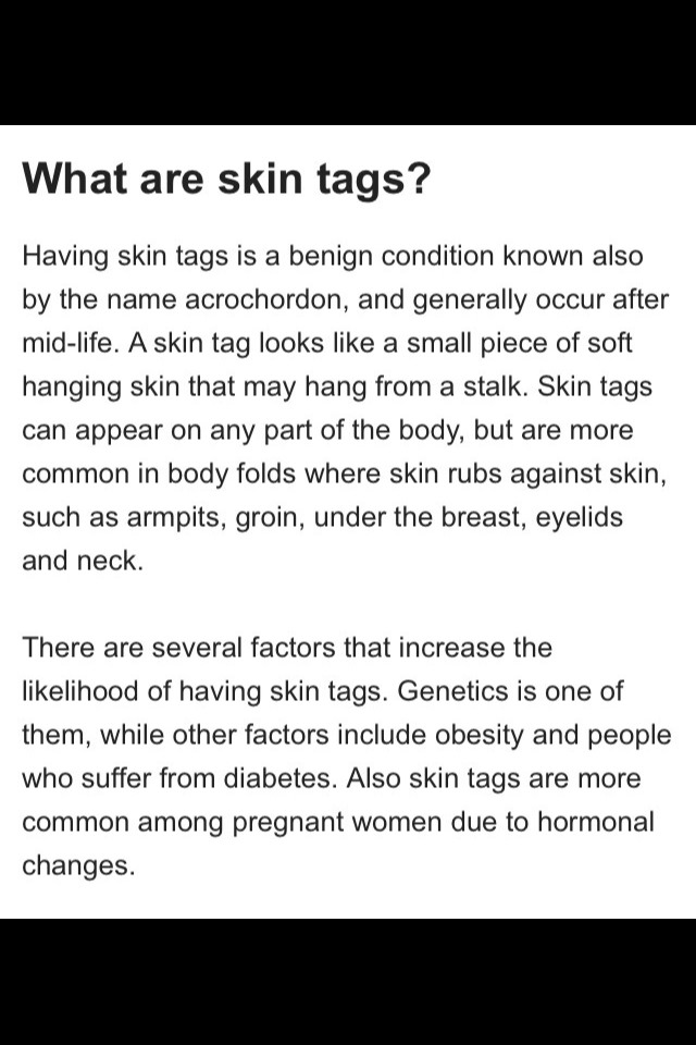 How To Remove Skin Tags And Warts Naturally And Cheaply At Home