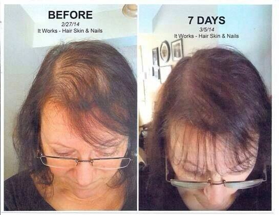 How To Grow Hair & Nails - Balance Skin