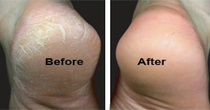 Dry feet?