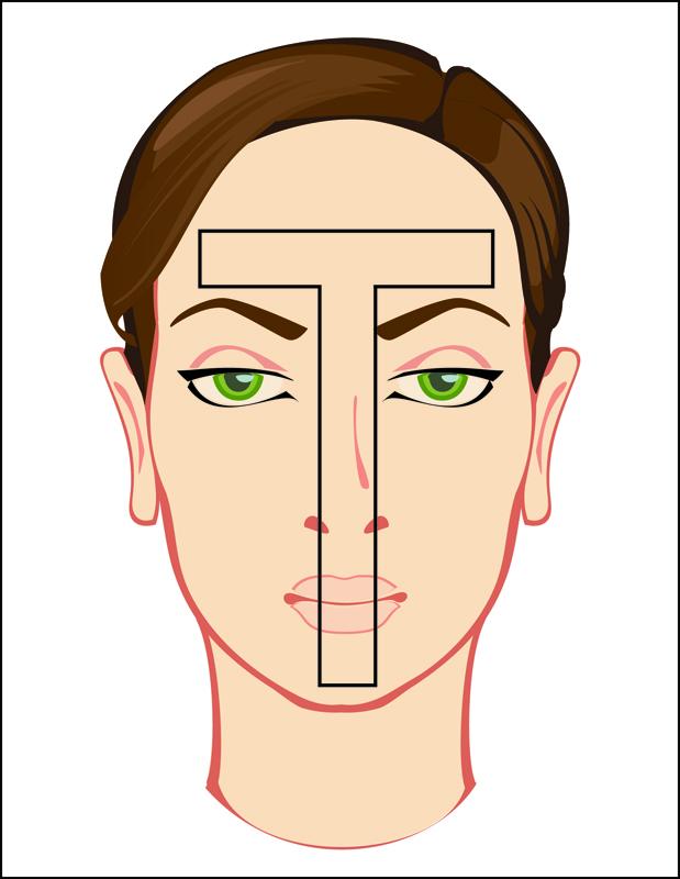 Breakouts between the brows can be caused by overindulgence of unhealthy foods or a food allergy. Cutting back on sugar, dairy, rich foods, and alcohol can help clear up skin in this zone.