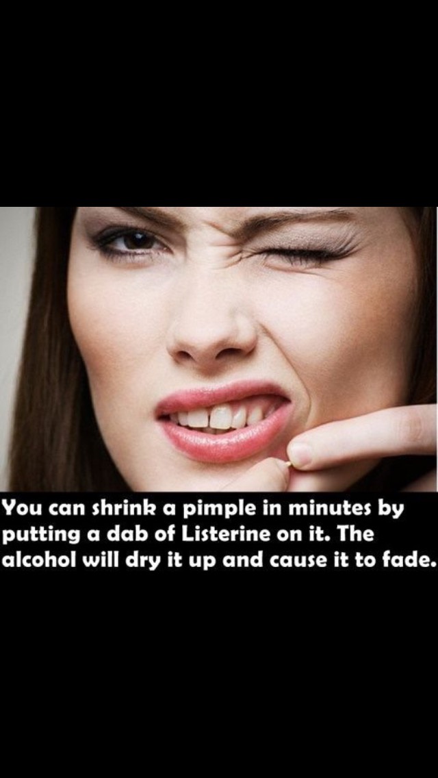 Simple Things